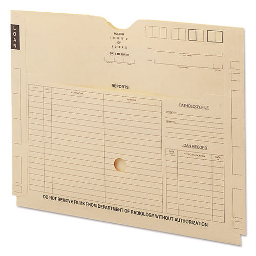 Image of Smead Pxr7 X-Ray Jackets With Pockets, Straight Tab, Manila, 100/box
